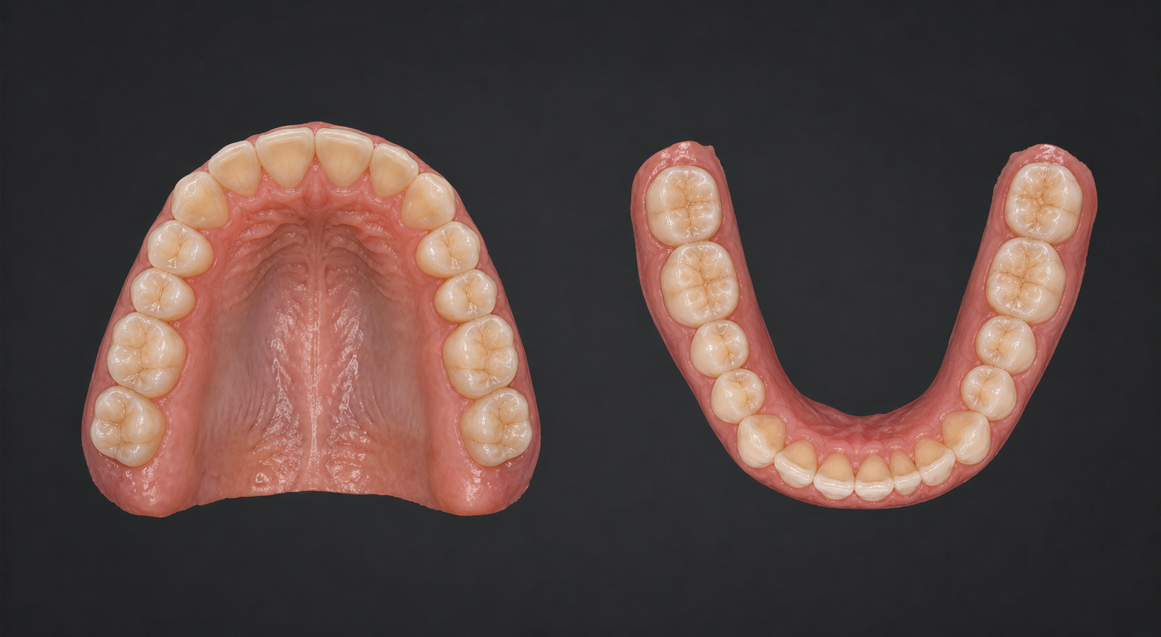 Illustrative three-dimensional intraoral scan showing upper and lower occlusal views